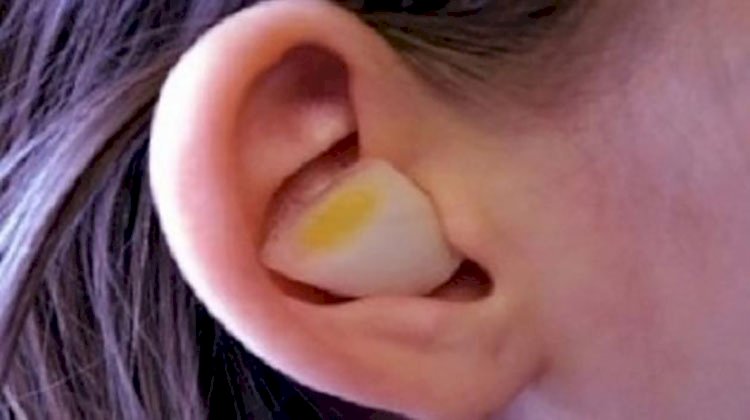 طرق علاج صديد الأذن