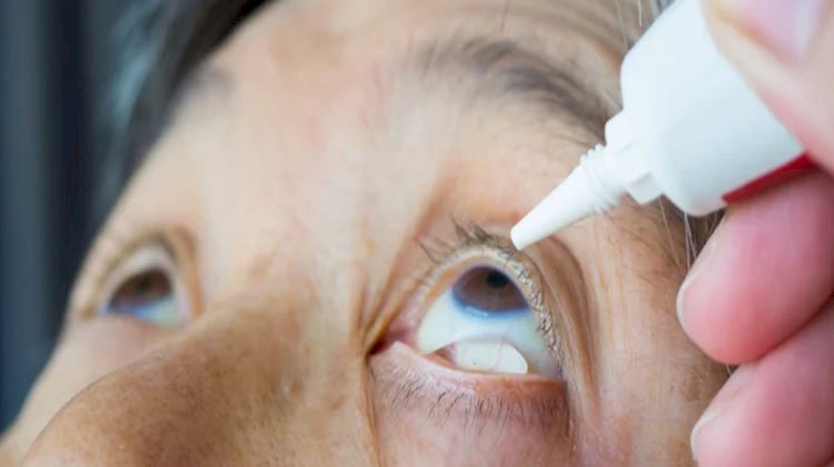 نصائح لعلاج جفاف العين فى عمر الأربعين