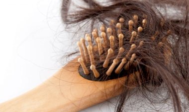 تساقط الشعر في الشتاء.. أسباب خفية ونصائح فعّالة للحد منه