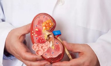 لو مريض كلى.. اعرف ضوابط الصيام خلال شهر رمضان