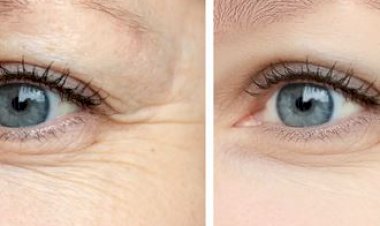 تعالج التجاعيد والبقع والحبوب .. مادة طبيعية مهملة تعالج أصعب مشاكل البشرة