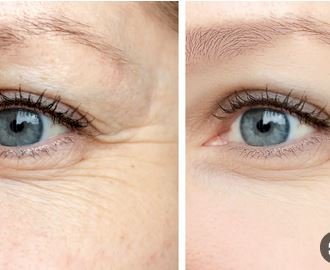 تعالج التجاعيد والبقع والحبوب .. مادة طبيعية مهملة تعالج أصعب مشاكل البشرة