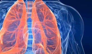 جلطة الرئة.. الأعراض والأسباب والفئات الأكثر عرضة للإصابة