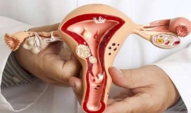 التهابات المهبل للمتزوجات.. الأسباب والأعراض وطرق العلاج والوقاية