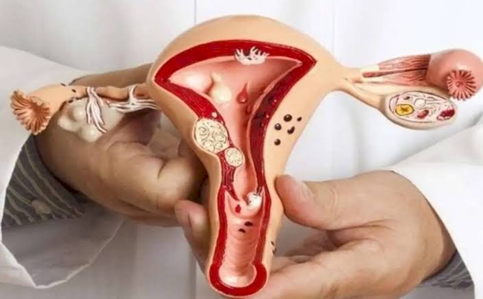 التهابات المهبل للمتزوجات.. الأسباب والأعراض وطرق العلاج والوقاية